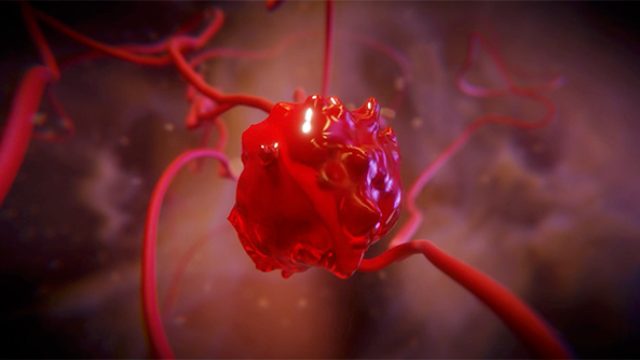 Film d'animation 3D — CHU de Lille