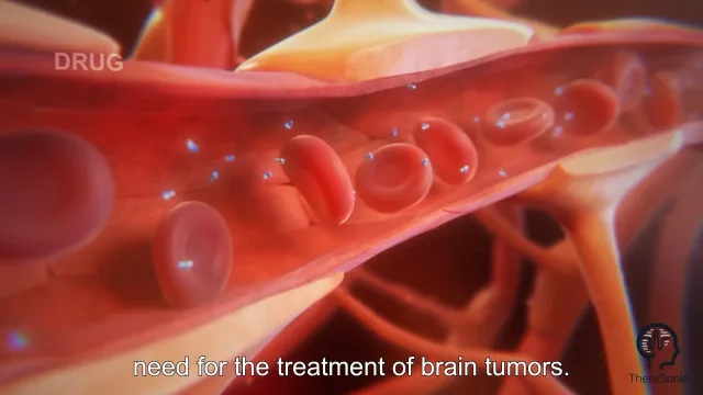 Film d'animation 3D — M2CARE- Therasonic
