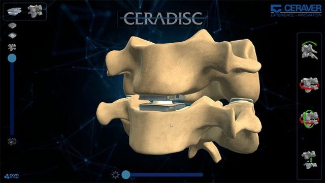 CERADISC Application de présentation