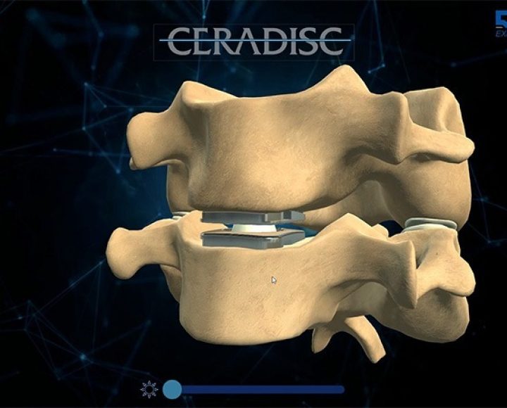 Application tactile — CERADISC Application de présentation