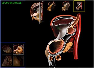CDROM médical sur la chirurgie Digestive - coupe sagitale