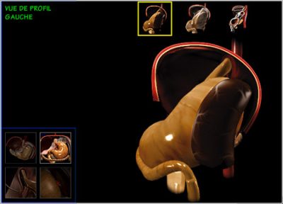 chirurgie digestives vue de profil 2