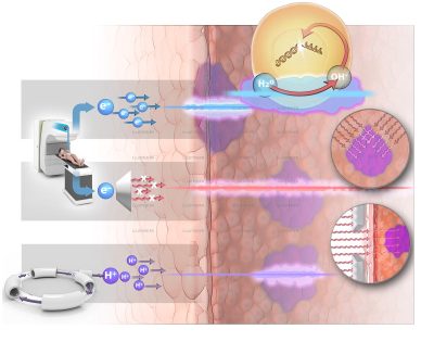 Science & Vie cancer, Rayonthérapie